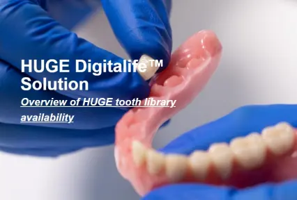 HUGE Digitalife™ Solution - Overview of HUGE tooth library availability