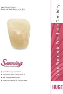 Sonning Mould Chart